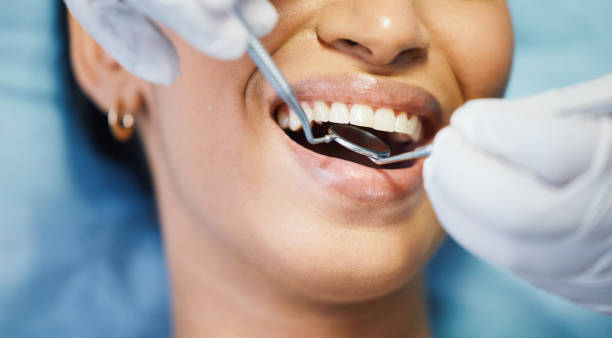 Best Emergency Tooth Extraction  in Lochbuie, CO